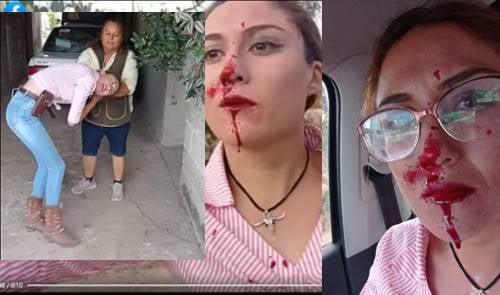 Vecina de Polotitlán denuncia agresión física de la delegada municipal